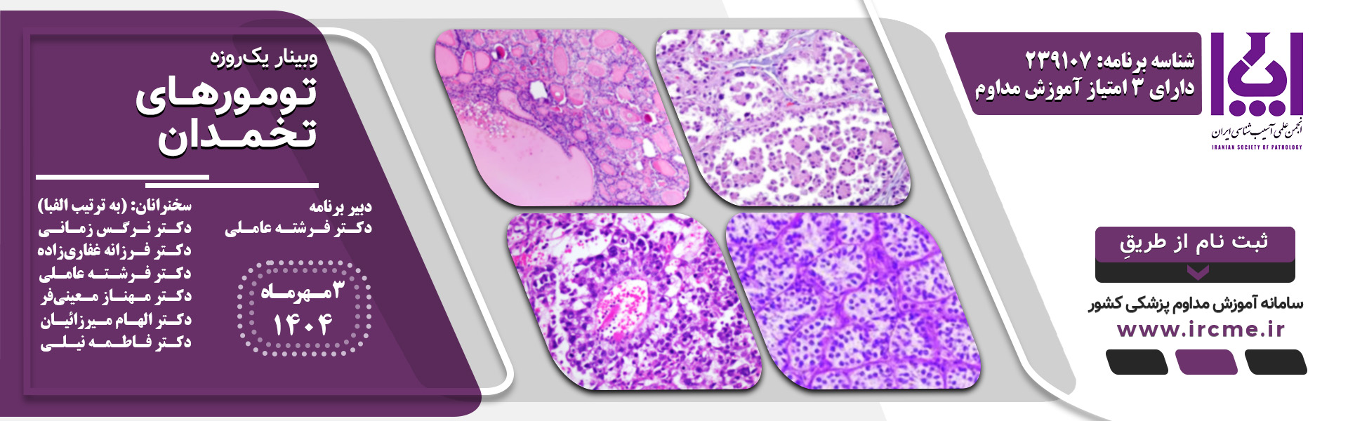 Ovarian Tumors