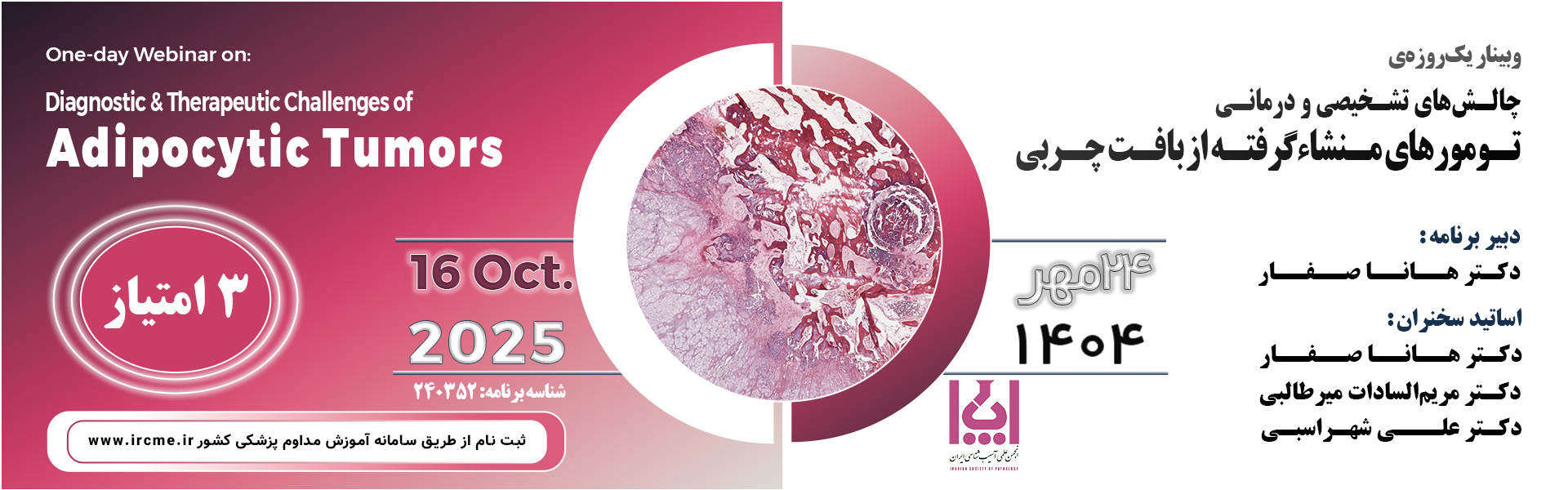 Diagnostic & Therapeutic Challenges Of Adipocytic Tumors